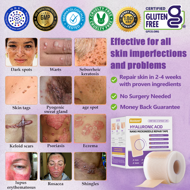 𝐓𝒐𝐭𝐚𝗹𝐧á 𝐬𝐞𝐛𝐚𝐬𝐭𝐞𝐣𝐧𝐨𝐬𝐭̌ 𝐳𝐚č𝐢́𝐧𝐚 𝐭𝐮✅ 𝐁𝒐𝒔𝐭𝒐𝐫𝗲® 𝐍𝐚𝐧𝐨 𝐦𝐢𝐜𝐫𝐨𝐢𝐈𝐧𝐞𝐞𝐝𝐥𝐞 𝐎𝐩𝐫𝐚𝐯𝐧á 𝐍á𝐥𝐞𝐩𝐤𝐚 𝐬 𝐊𝐲𝐬𝐞𝐥𝐢𝐧𝐨𝐮 𝐇𝐲𝐚𝐥𝐮𝐫𝐨́𝐧𝐨𝐯𝐨𝐮✴ Pre rôzne jazvy, strie, škvrny, keloidy, keratózy, akné, popáleniny, bradavice, kožné výrastky a kŕčové žily.