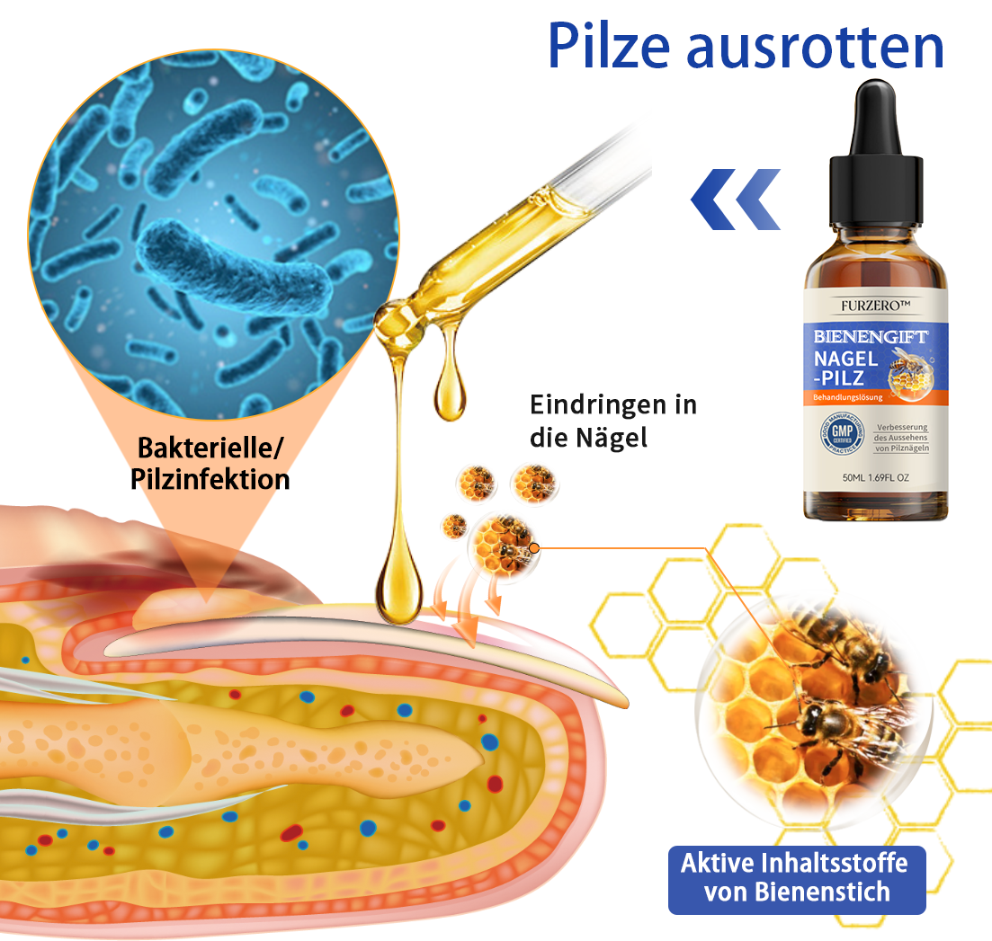 Furzero™ Bienengift Nagelpilz Behandlungslösung:Das Nagelpilzproblem vollständig lösen🌟