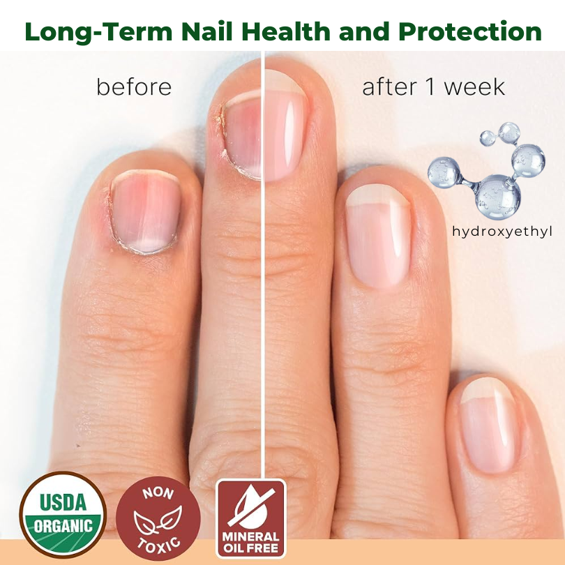 Biancat™ NailNurture Olej na liečbu plesní včelím jedom -👨⚕️ Schválila Americká dermatologická akadémia (AAD)