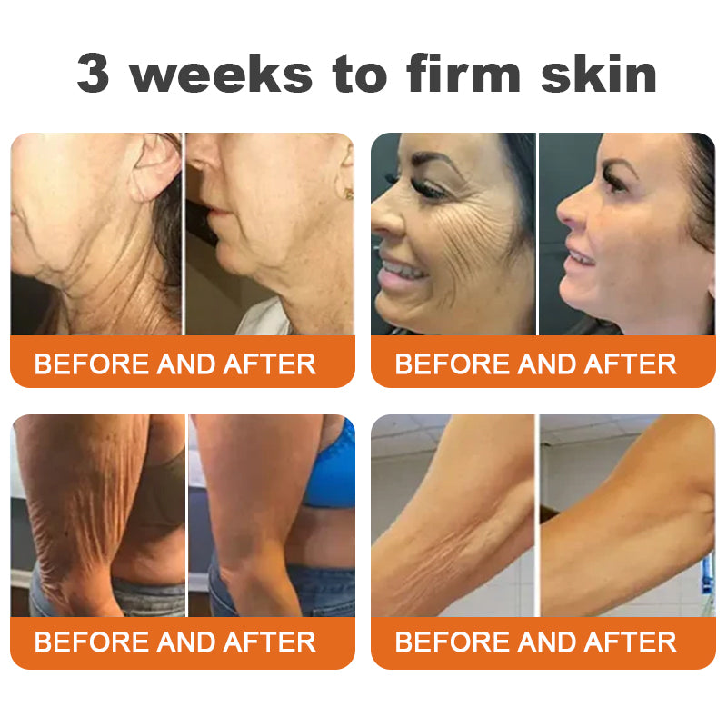 ✨Flysmus™ Botox Spevňujúce sérum so včelím jedom🔥POSLEDNÝ DEŇ 70% ZĽAVA