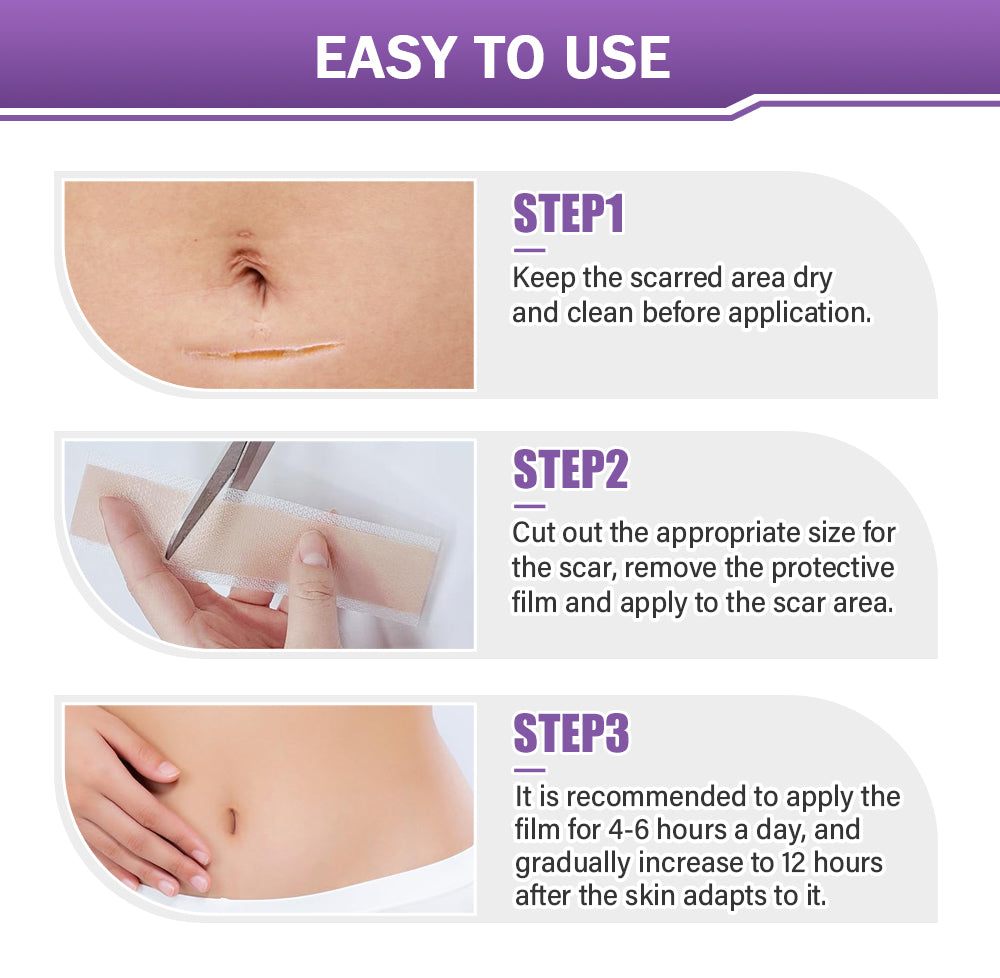 𝐓𝒐𝐭𝐚𝗹𝐧á 𝐬𝐞𝐛𝐚𝐬𝐭𝐞𝐣𝐧𝐨𝐬𝐭̌ 𝐳𝐚č𝐢́𝐧𝐚 𝐭𝐮✅ 𝐁𝒐𝒔𝐭𝒐𝐫𝗲® 𝐍𝐚𝐧𝐨 𝐦𝐢𝐜𝐫𝐨𝐢𝐈𝐧𝐞𝐞𝐝𝐥𝐞 𝐎𝐩𝐫𝐚𝐯𝐧á 𝐍á𝐥𝐞𝐩𝐤𝐚 𝐬 𝐊𝐲𝐬𝐞𝐥𝐢𝐧𝐨𝐮 𝐇𝐲𝐚𝐥𝐮𝐫𝐨́𝐧𝐨𝐯𝐨𝐮✴ Pre rôzne jazvy, strie, škvrny, keloidy, keratózy, akné, popáleniny, bradavice, kožné výrastky a kŕčové žily.