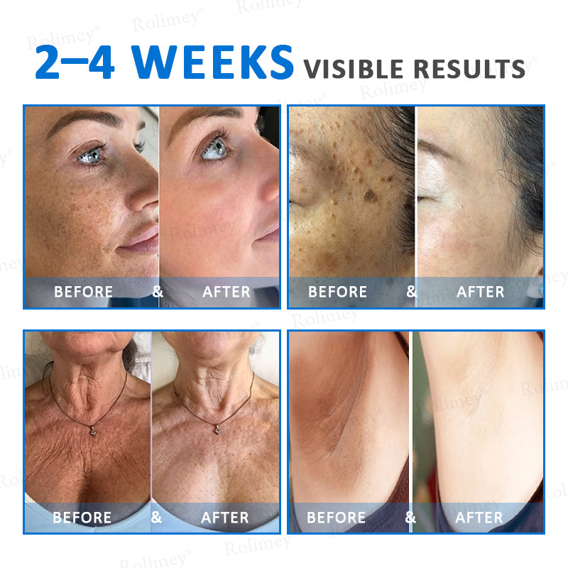 ✨✨💧(Vyrobené a odoslané z Austrálie)✨Rolimey® Pokročilý spevňujúci a protivráskový krém (s SPF 50+)✨POSLEDNÝ DEŇ ZĽAVA 60%