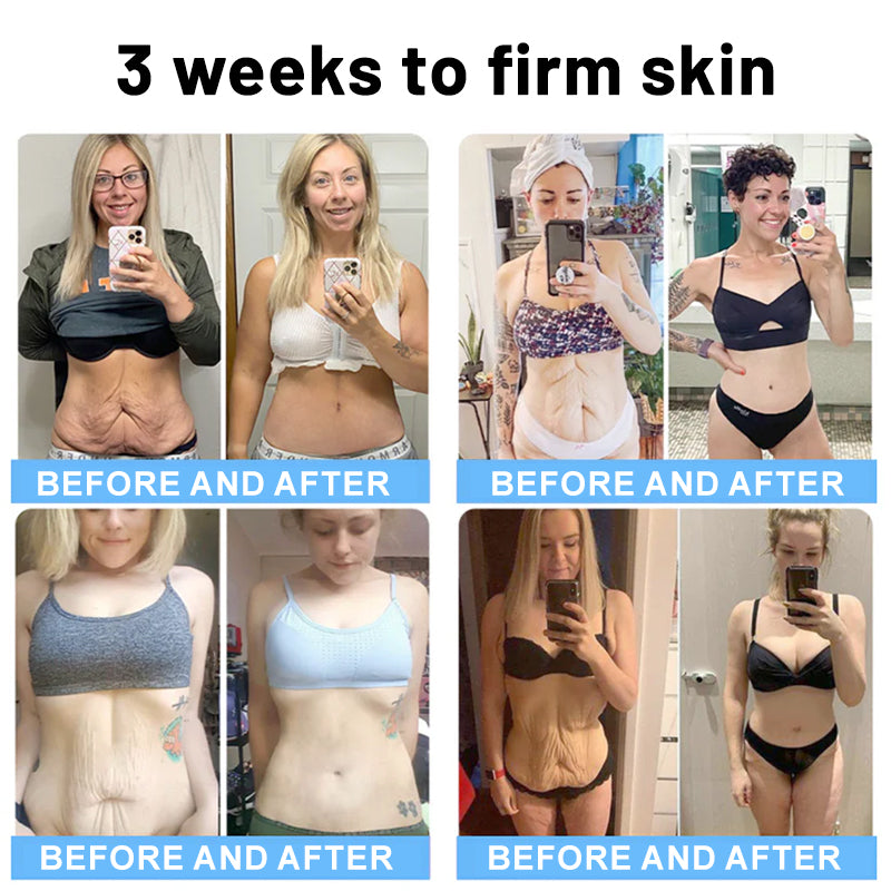 ✨💧Flysmus® Skin Firming Cream,Addressing Crepe & Sagging