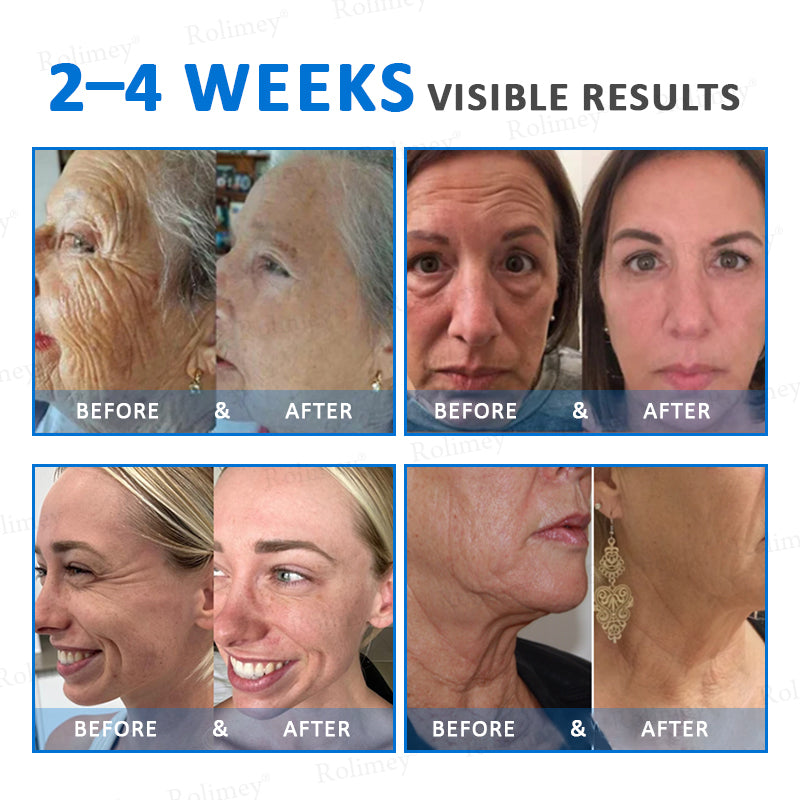 ✨✨💧(Vyrobené a odoslané z Austrálie)✨Rolimey® Pokročilý spevňujúci a protivráskový krém (s SPF 50+)✨POSLEDNÝ DEŇ ZĽAVA 60%