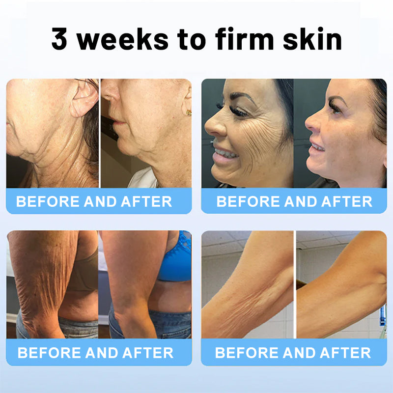 ✨💧Flysmus® Skin Firming Cream,Addressing Crepe & Sagging