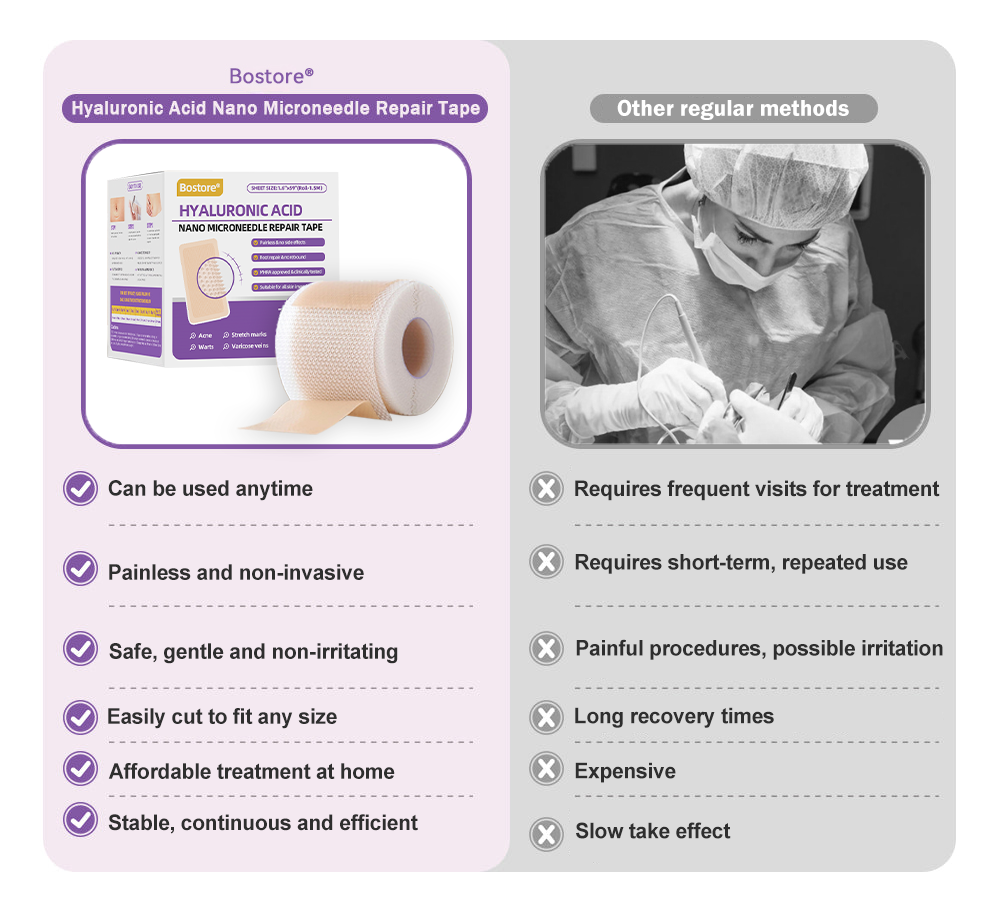 𝐓𝒐𝐭𝐚𝗹𝐧á 𝐬𝐞𝐛𝐚𝐬𝐭𝐞𝐣𝐧𝐨𝐬𝐭̌ 𝐳𝐚č𝐢́𝐧𝐚 𝐭𝐮✅ 𝐁𝒐𝒔𝐭𝒐𝐫𝗲® 𝐍𝐚𝐧𝐨 𝐦𝐢𝐜𝐫𝐨𝐢𝐈𝐧𝐞𝐞𝐝𝐥𝐞 𝐎𝐩𝐫𝐚𝐯𝐧á 𝐍á𝐥𝐞𝐩𝐤𝐚 𝐬 𝐊𝐲𝐬𝐞𝐥𝐢𝐧𝐨𝐮 𝐇𝐲𝐚𝐥𝐮𝐫𝐨́𝐧𝐨𝐯𝐨𝐮✴ Pre rôzne jazvy, strie, škvrny, keloidy, keratózy, akné, popáleniny, bradavice, kožné výrastky a kŕčové žily.