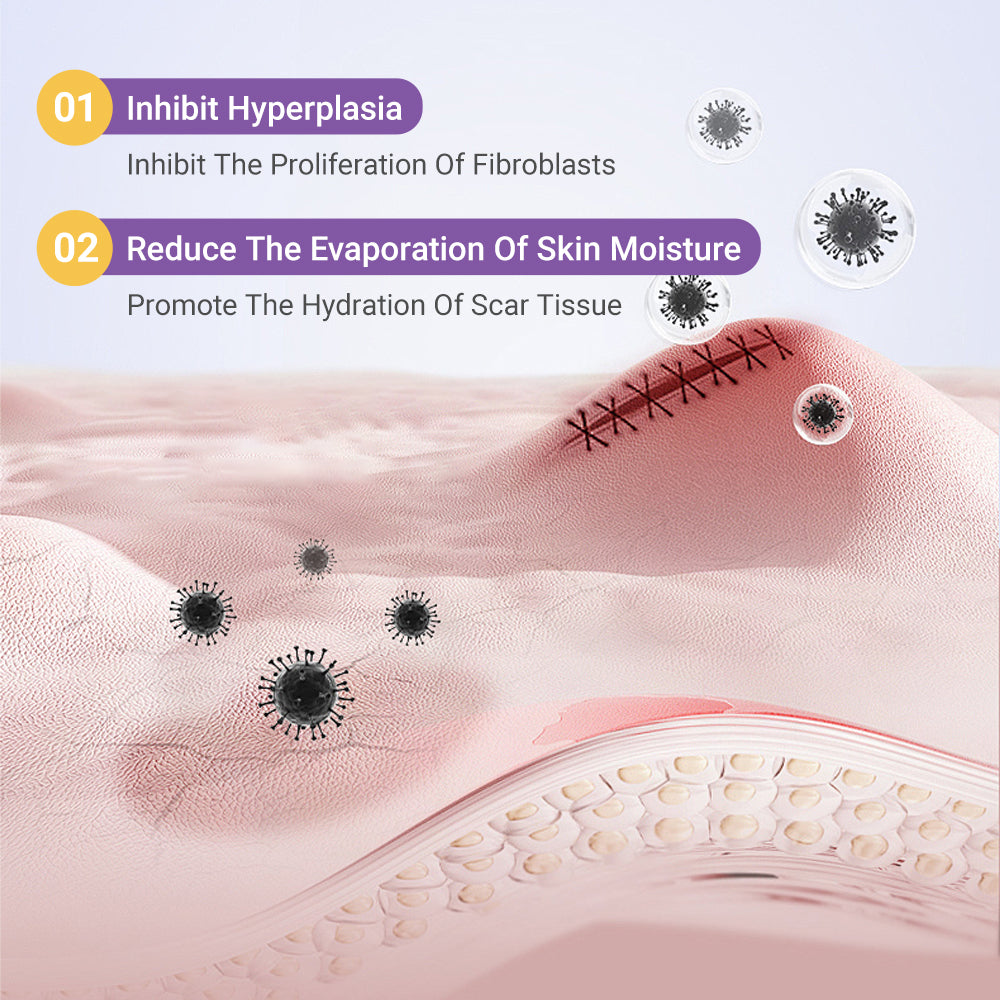 𝐓𝒐𝐭𝐚𝗹𝐧á 𝐬𝐞𝐛𝐚𝐬𝐭𝐞𝐣𝐧𝐨𝐬𝐭̌ 𝐳𝐚č𝐢́𝐧𝐚 𝐭𝐮✅ 𝐁𝒐𝒔𝐭𝒐𝐫𝗲® 𝐍𝐚𝐧𝐨 𝐦𝐢𝐜𝐫𝐨𝐢𝐈𝐧𝐞𝐞𝐝𝐥𝐞 𝐎𝐩𝐫𝐚𝐯𝐧á 𝐍á𝐥𝐞𝐩𝐤𝐚 𝐬 𝐊𝐲𝐬𝐞𝐥𝐢𝐧𝐨𝐮 𝐇𝐲𝐚𝐥𝐮𝐫𝐨́𝐧𝐨𝐯𝐨𝐮✴ Pre rôzne jazvy, strie, škvrny, keloidy, keratózy, akné, popáleniny, bradavice, kožné výrastky a kŕčové žily.