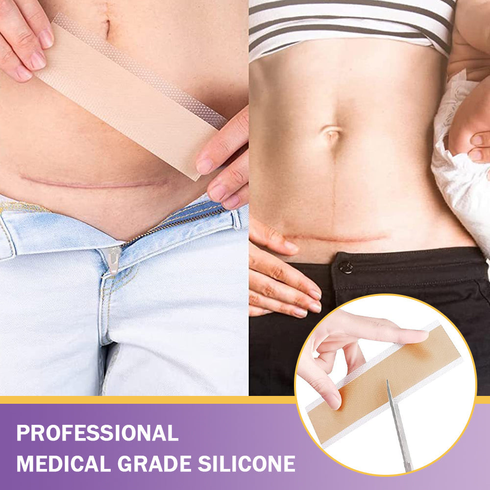 𝐓𝒐𝐭𝐚𝗹𝐧á 𝐬𝐞𝐛𝐚𝐬𝐭𝐞𝐣𝐧𝐨𝐬𝐭̌ 𝐳𝐚č𝐢́𝐧𝐚 𝐭𝐮✅ 𝐁𝒐𝒔𝐭𝒐𝐫𝗲® 𝐍𝐚𝐧𝐨 𝐦𝐢𝐜𝐫𝐨𝐢𝐈𝐧𝐞𝐞𝐝𝐥𝐞 𝐎𝐩𝐫𝐚𝐯𝐧á 𝐍á𝐥𝐞𝐩𝐤𝐚 𝐬 𝐊𝐲𝐬𝐞𝐥𝐢𝐧𝐨𝐮 𝐇𝐲𝐚𝐥𝐮𝐫𝐨́𝐧𝐨𝐯𝐨𝐮✴ Pre rôzne jazvy, strie, škvrny, keloidy, keratózy, akné, popáleniny, bradavice, kožné výrastky a kŕčové žily.