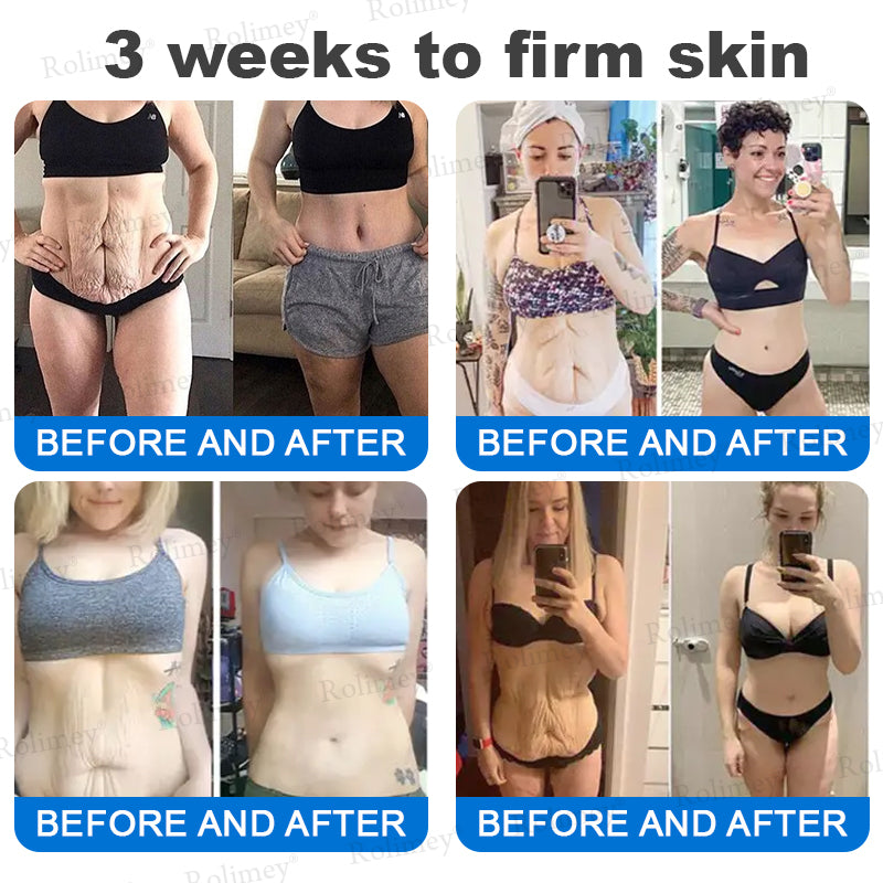✨✨💧(Vyrobené a odoslané z Austrálie)✨Rolimey® Pokročilý spevňujúci a protivráskový krém (s SPF 50+)✨POSLEDNÝ DEŇ ZĽAVA 60%
