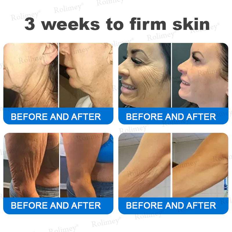 ✨✨💧(Vyrobené a odoslané z Austrálie)✨Rolimey® Pokročilý spevňujúci a protivráskový krém (s SPF 50+)✨POSLEDNÝ DEŇ ZĽAVA 60%