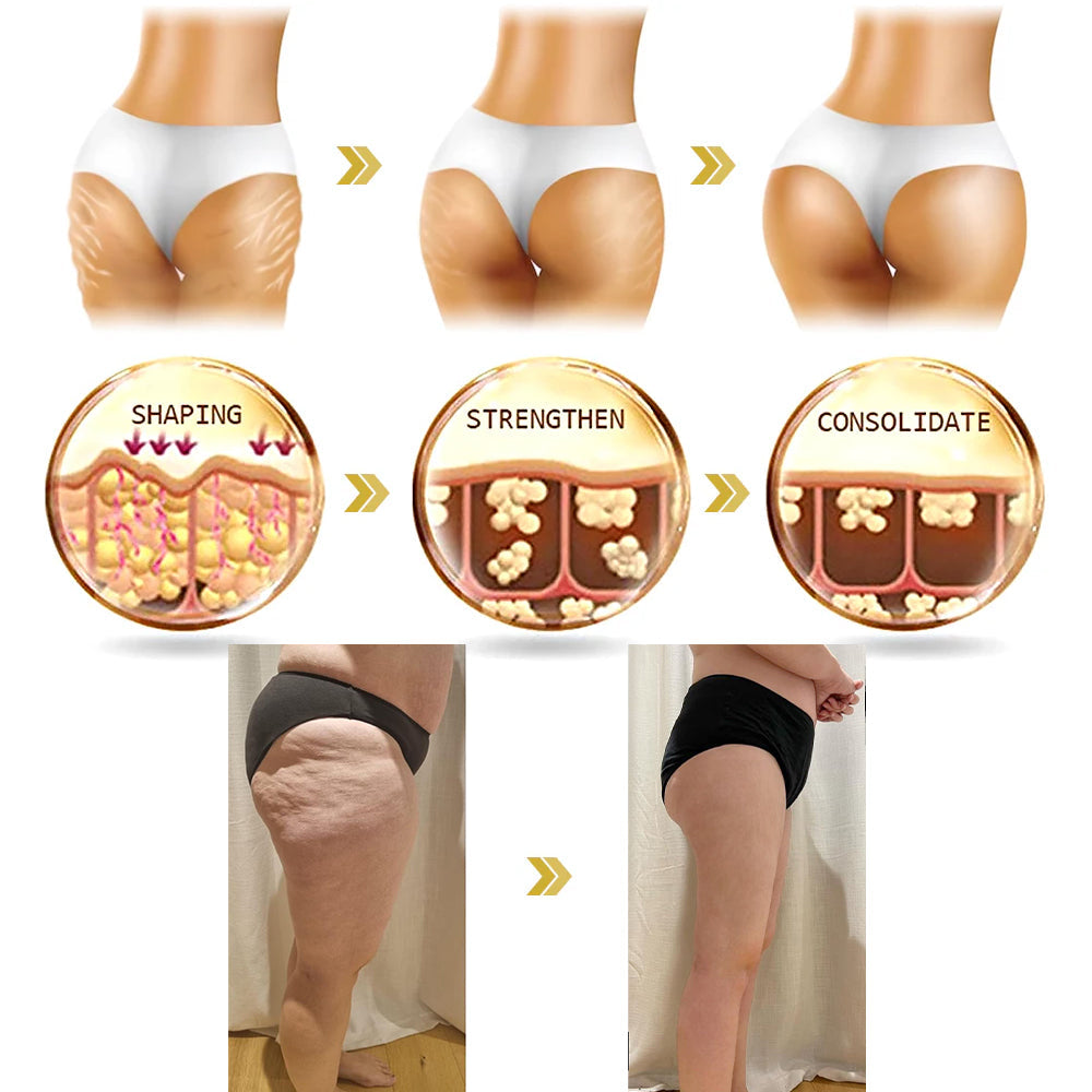 ✨💧Flysmus® Skin Firming Cream,Addressing Crepe & Sagging