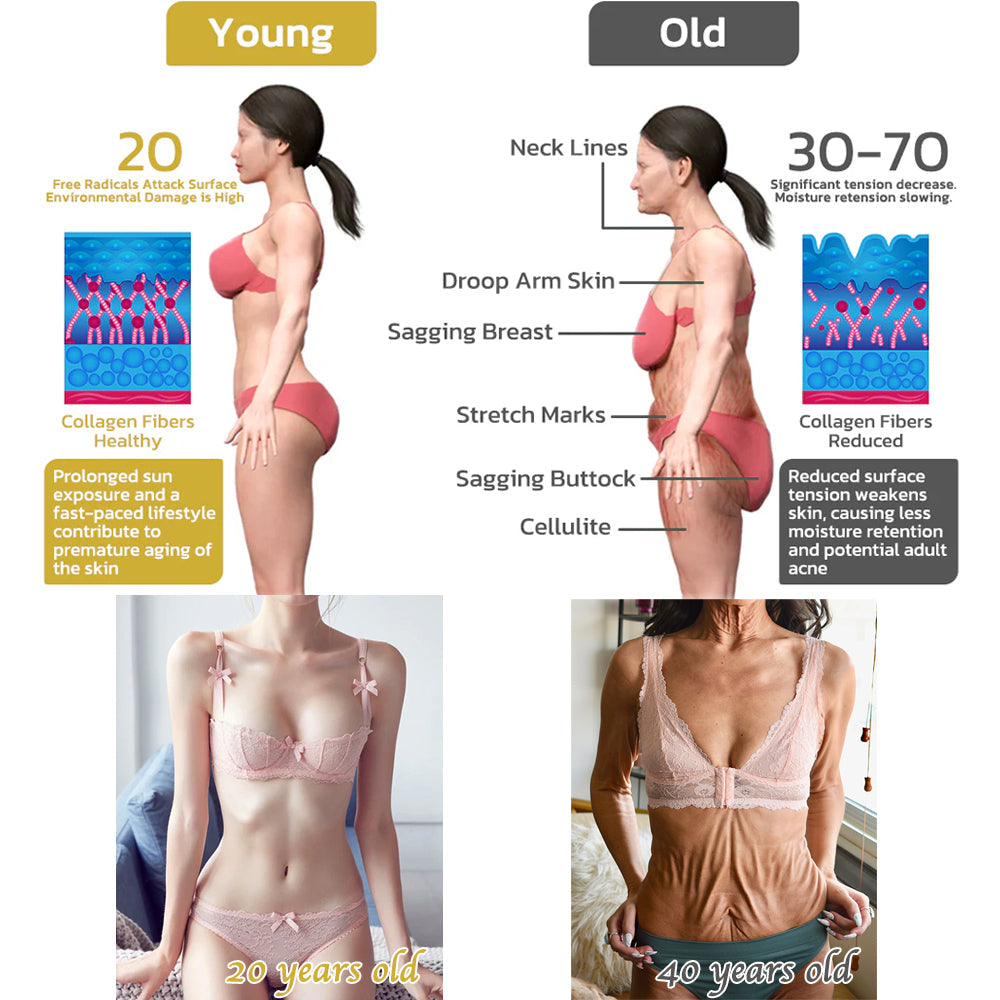 ✨💧Flysmus® Skin Firming Cream,Addressing Crepe & Sagging
