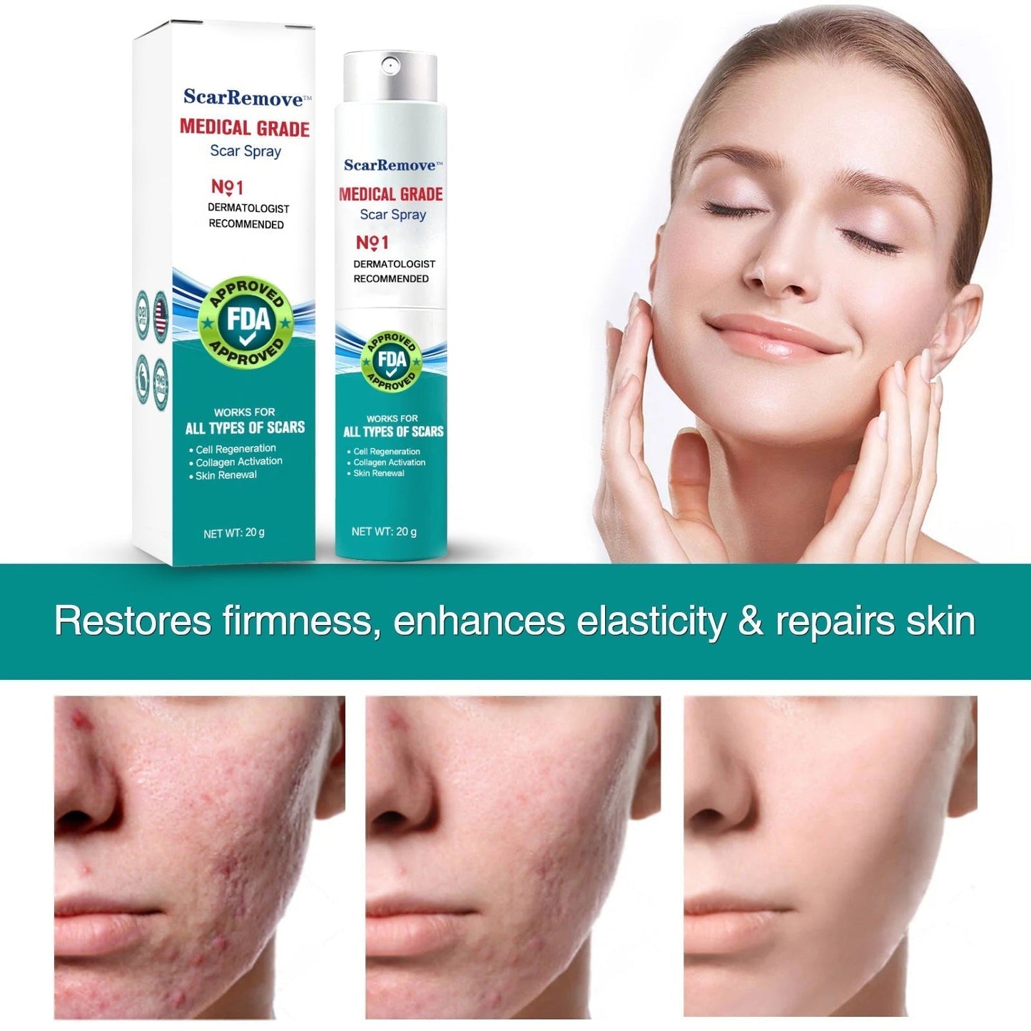 🔥🔥🔥ScarRemove™ Advanced Scar Spray na všetky typy jaziev - najmä jazvy po akné, chirurgické jazvy a strie