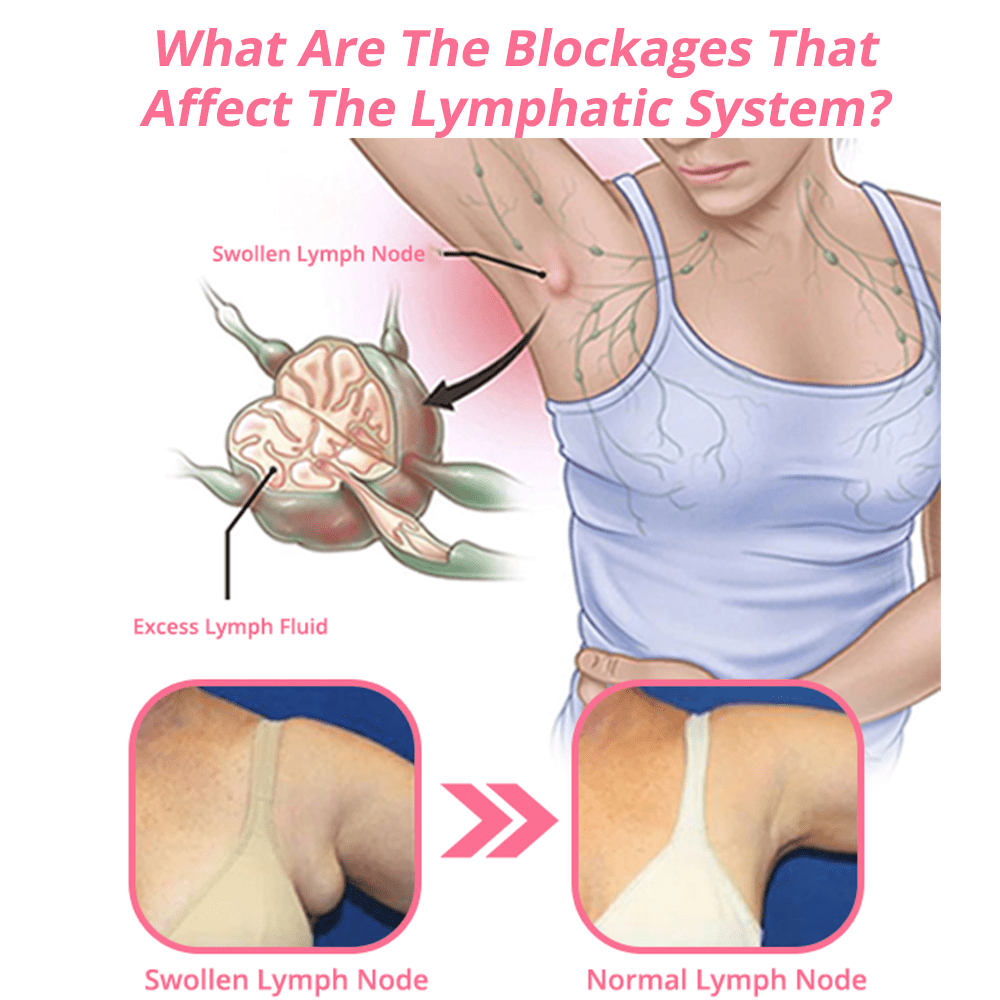 flysmus™ Lymfoterapia MagneTherapy Germániové náušnice
