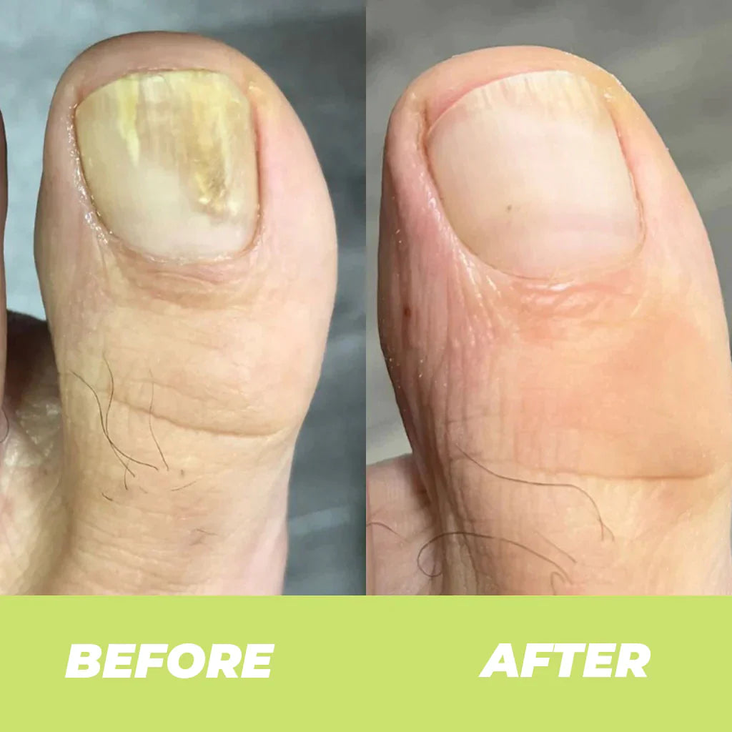NailDOC™ Gél Na Ošetrenie Nechtov