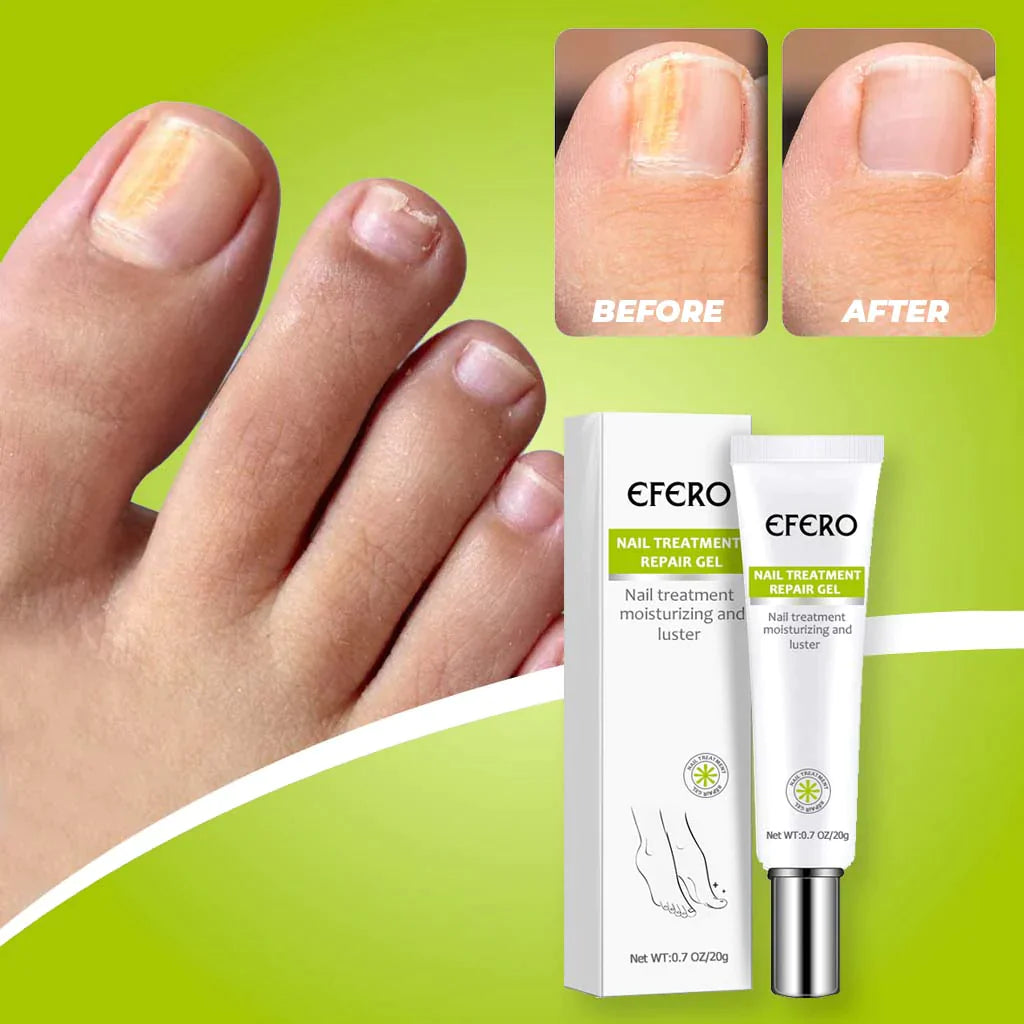 NailDOC™ Gél Na Ošetrenie Nechtov