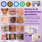 𝐓𝒐𝐭𝐚𝗹𝐧á 𝐬𝐞𝐛𝐚𝐬𝐭𝐞𝐣𝐧𝐨𝐬𝐭̌ 𝐳𝐚č𝐢́𝐧𝐚 𝐭𝐮✅ 𝐁𝒐𝒔𝐭𝒐𝐫𝗲® 𝐍𝐚𝐧𝐨 𝐦𝐢𝐜𝐫𝐨𝐢𝐈𝐧𝐞𝐞𝐝𝐥𝐞 𝐎𝐩𝐫𝐚𝐯𝐧á 𝐍á𝐥𝐞𝐩𝐤𝐚 𝐬 𝐊𝐲𝐬𝐞𝐥𝐢𝐧𝐨𝐮 𝐇𝐲𝐚𝐥𝐮𝐫𝐨́𝐧𝐨𝐯𝐨𝐮✴ Pre rôzne jazvy, strie, škvrny, keloidy, keratózy, akné, popáleniny, bradavice, kožné výrastky a kŕčové žily.