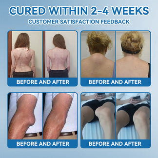 𝖯𝗂𝖼𝗱𝗼® BPC-157 Krém na hojenie kĺbov