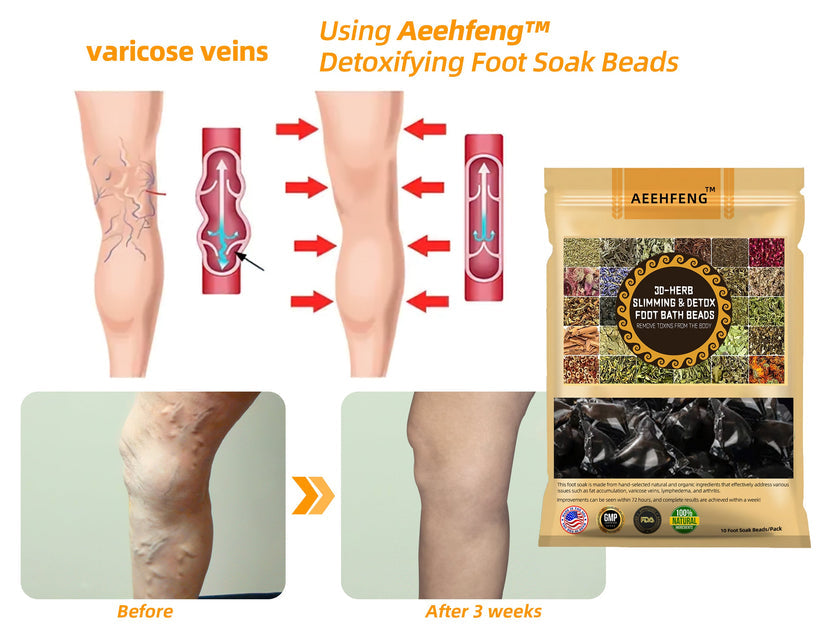 Aeehfeng™ 30-Herb Slimming & Detox Foot - (👩‍⚕️AVLS Certifikácia)