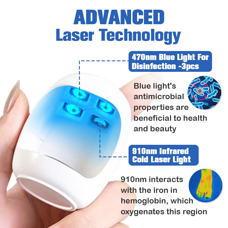 (🔥LIMITOVANÁ ZĽAVA 70% - POSLEDNÝ DEŇ🔥)Zariadenie Furzero™ na laserové odstraňovanie plesní nechtov