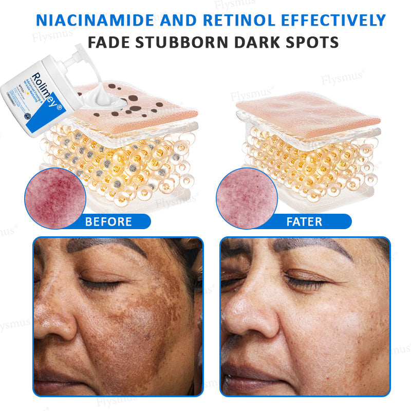 ✨✨💧(Vyrobené a odoslané z Austrálie)✨Rolimey® Pokročilý spevňujúci a protivráskový krém (s SPF 50+)✨POSLEDNÝ DEŇ ZĽAVA 60%