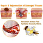 🌿🌿[✨Official Brand Store✨] Zoencgz™ Bee Poison Moles & Warts Cream (👨‍⚕Препоръчва je od AAD)